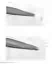 Fig. 06 - PERCUTANEOUS SCALPEL AND TISSUE DILATOR
