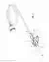 Fig. 02 - Butterfly needle with a protective device