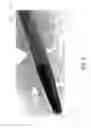 Fig. 06 - ACTIVELY TRACKED MEDICAL DEVICES
