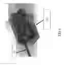 Fig. 07 - ACTIVELY TRACKED MEDICAL DEVICES