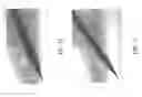 Fig. 15 - ACTIVELY TRACKED MEDICAL DEVICES