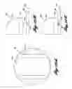 Fig. 12 - CUTANEOUS TREATMENT APPARATUS AND METHODS OF USE