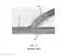 Fig. 05 - BALLOON CATHETER HAVING MICRO NEEDLES AND MANUFACTURING METHOD FOR THE SAME