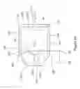 Fig. 08 - Catheter assembly