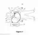 Fig. 02 - Electrode assembly having various communicative solutions