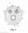 Fig. 04 - Lead with textured insulative layer