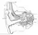 Fig. 01 - Electrode for common cavity cochlear malformation