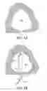 Fig. 06 - Electrode for common cavity cochlear malformation