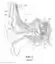 Fig. 02 - Tissue Penetrating Electrode