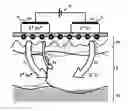 Fig. 01 - Device for treating a cutaneous ulcer