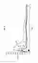 Fig. 03 - Device for treating a cutaneous ulcer