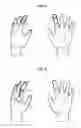 Fig. 05 - Device for treating a cutaneous ulcer