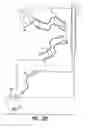 Fig. 04 - Patient programmer for implantable devices