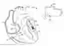 Fig. 01 - SYSTEMS AND METHODS FOR FIXATING TRANSVENOUSLY IMPLANTED MEDICAL DEVICES