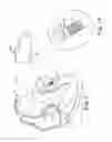 Fig. 02 - SYSTEMS AND METHODS FOR FIXATING TRANSVENOUSLY IMPLANTED MEDICAL DEVICES