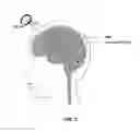 Fig. 04 - Method for non-invasive brain stimulation