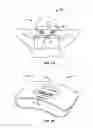 Fig. 02 - METHODS AND SYSTEMS FOR PREVENTATIVE MIGRAINE HEADACHE TREATMENT