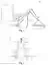 Fig. 02 - Victim retrieval system, method and appratus
