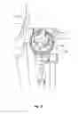 Fig. 04 - Adjustable Stride Length in an Exercise Machine