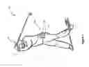 Fig. 06 - ASSEMBLY FACILITATING A PROPER SWING MOTION