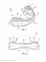 Fig. 02 - PERFORMANCE ENHANCING BITE REGULATOR AND SELF-IMPRESSION SYSTEM AND METHOD OF CUSTOM FITTING SAME