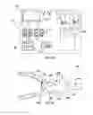 Fig. 16 - PERFORMANCE ENHANCING BITE REGULATOR AND SELF-IMPRESSION SYSTEM AND METHOD OF CUSTOM FITTING SAME