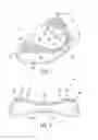 Fig. 02 - PERFORMANCE ENHANCING BITE REGULATOR AND SELF-IMPRESSION SYSTEM AND METHOD OF CUSTOM FITTING SAME
