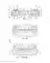 Fig. 05 - PERFORMANCE ENHANCING BITE REGULATOR AND SELF-IMPRESSION SYSTEM AND METHOD OF CUSTOM FITTING SAME