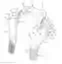 Fig. 01 - Head and neck restraint device with dynamic articulation