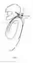 Fig. 02 - Head and neck restraint device with dynamic articulation