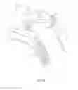 Fig. 32 - Head and neck restraint device with dynamic articulation