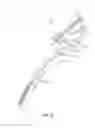 Fig. 34 - Head and neck restraint device with dynamic articulation