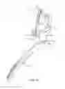 Fig. 36 - Head and neck restraint device with dynamic articulation