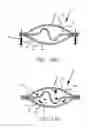 Fig. 07 - Device for facilitating a chemical reaction