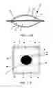Fig. 10 - Device for facilitating a chemical reaction