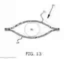 Fig. 11 - Device for facilitating a chemical reaction
