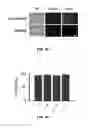 Fig. 10 - Magnetic separation filters for microfluidic devices