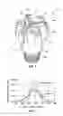 Fig. 02 - Earth-boring tools with precise cutter pocket location and orientation and related methods