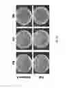 Fig. 15 - Scalable manufacturing of superhydrophobic structures in plastics