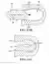 Fig. 22 - Filter for a pneumatic tire