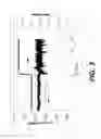 Fig. 04 - DRIVE TRAIN SLIP FOR VIBRATION MITIGATION DURING SKIP FIRE OPERATION