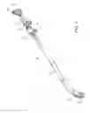 Fig. 07 - ANTI-BIND SLEEVE ADJUSTER FOR STEERING LINKAGE