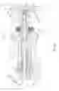 Fig. 14 - Vehicle wheel axle assembly