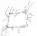 Fig. 01 - Gusset grip containers and methods for the manufacture thereof