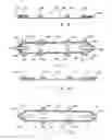 Fig. 10 - Buried pipeline repair system