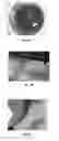 Fig. 06 - Compositions and methods for reducing nitrogen volatilization of urea fertilizers