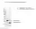 Fig. 03 - Compositions and methods of use for recombinant human secretoglobins