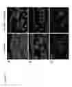 Fig. 15 - Methods and compositions for treating cancer and inflammatory diseases