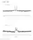 Fig. 24 - Stabilized insulinotropic peptides and methods of use