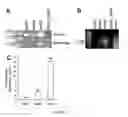 Fig. 53 - IMMUNOTHERAPY AND DIAGNOSIS OF MUCORMYCOSIS USING COTH